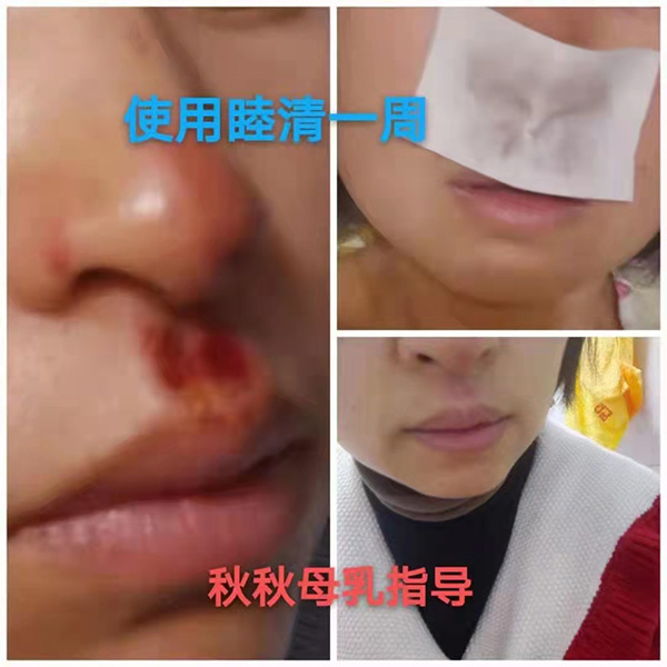 �����澏���N���Æ������M�߿ڱ������������aƷȦ�۟o��