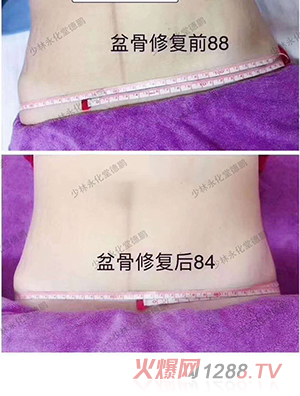 ���������îa���Ŀ-�����ޏ�